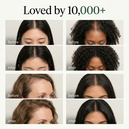 Korean Scalp Revival Bar